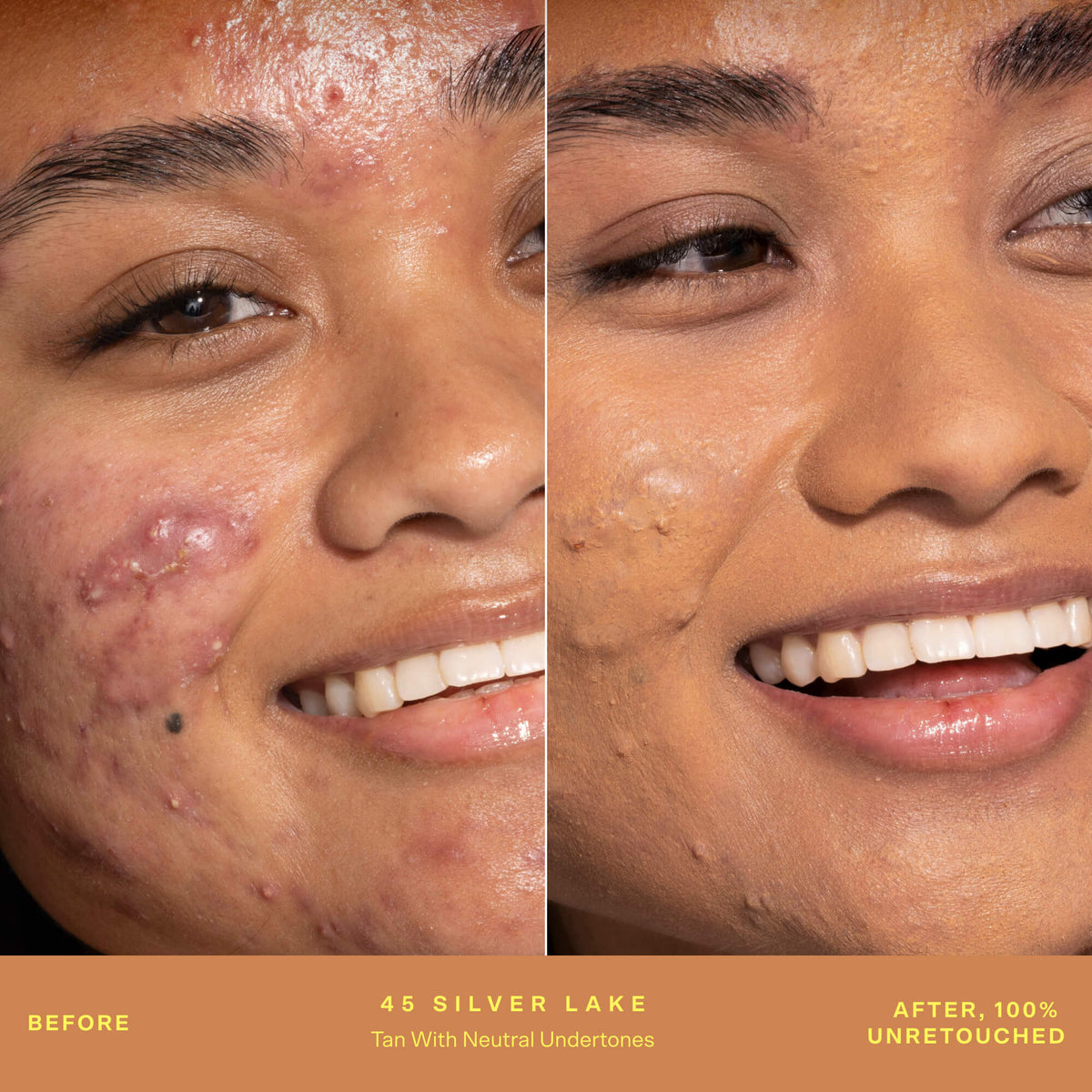 SunnyDays™ Tinted SPF 30 L1