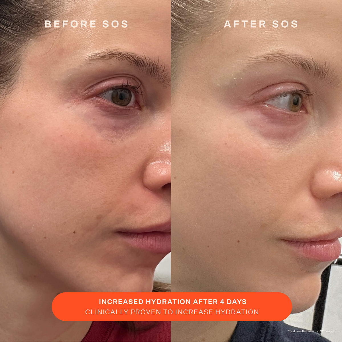 SOS Recovery Cream C5