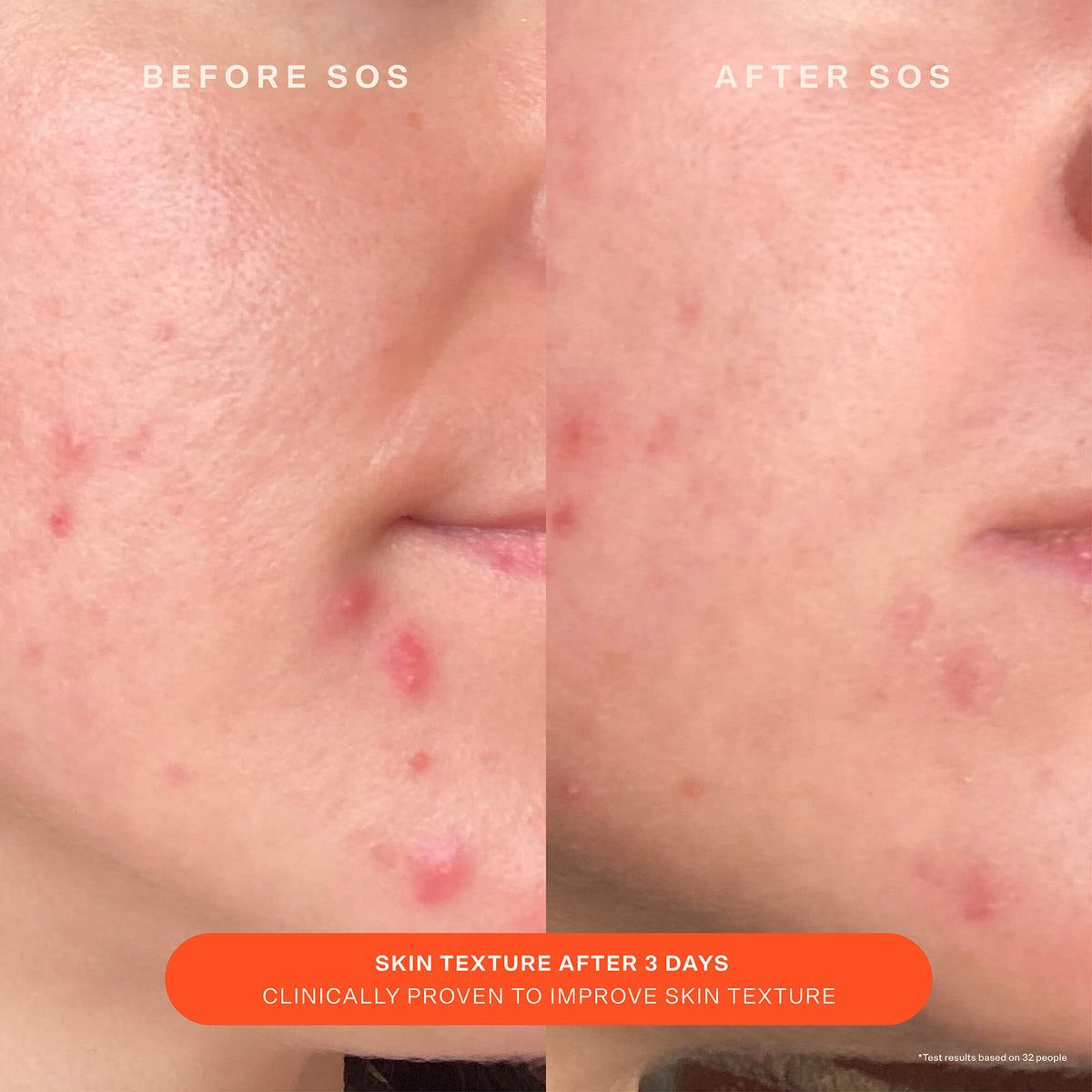 SOS Recovery Cream C5