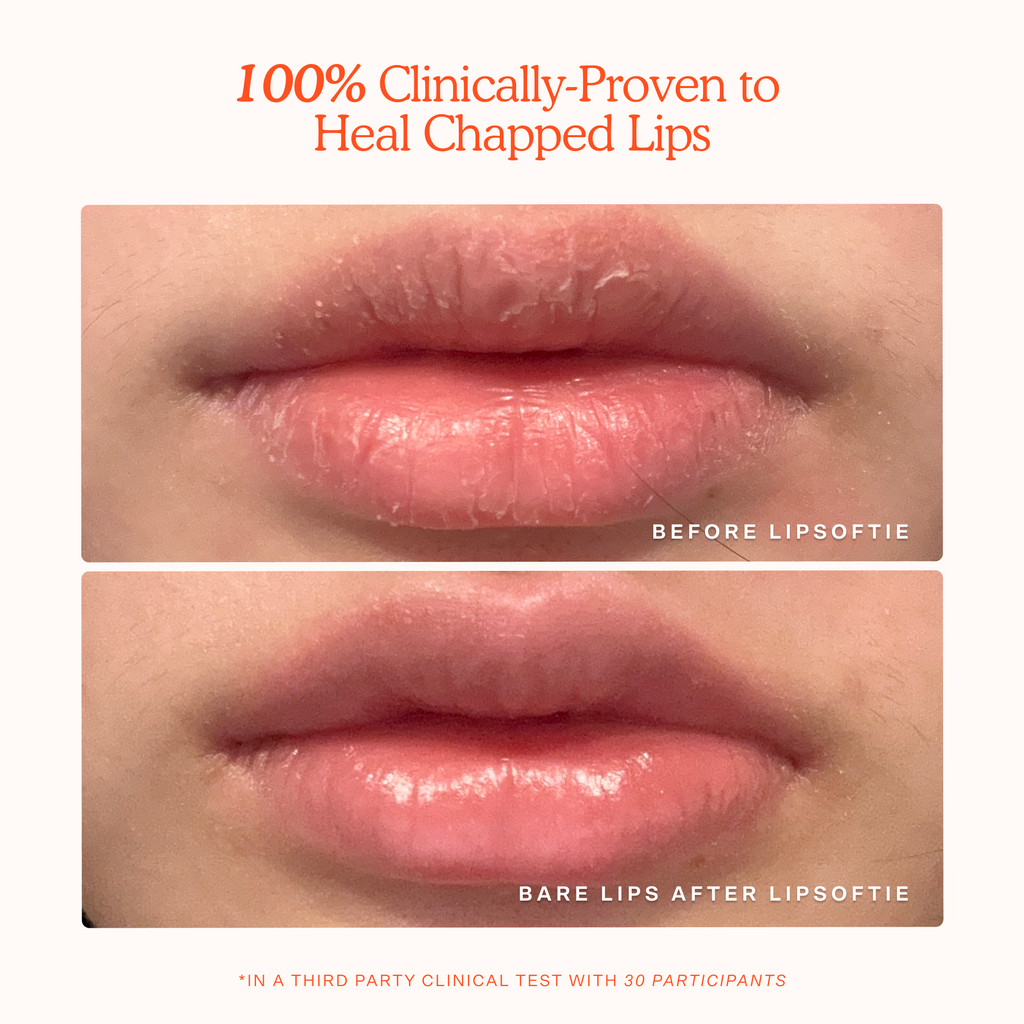 LipSoftie® Lip Treatment H3