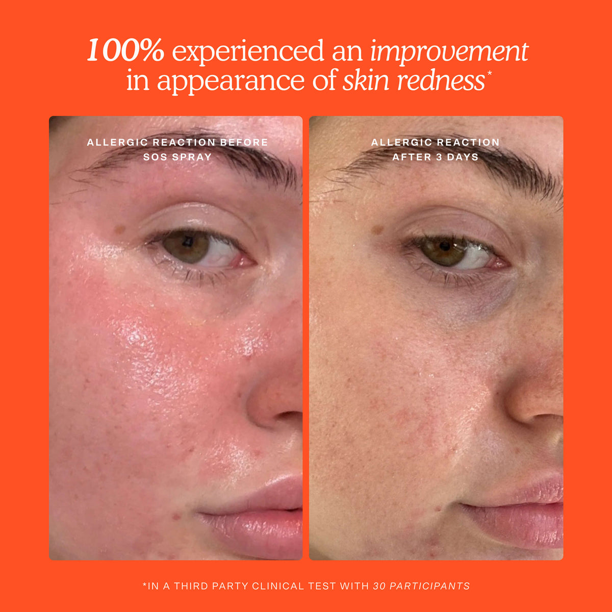 SOS Skincare Minis Kit Y1