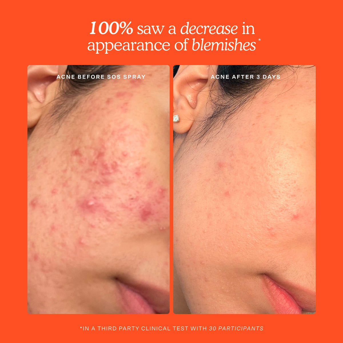 SOS Skincare Minis Kit Y1