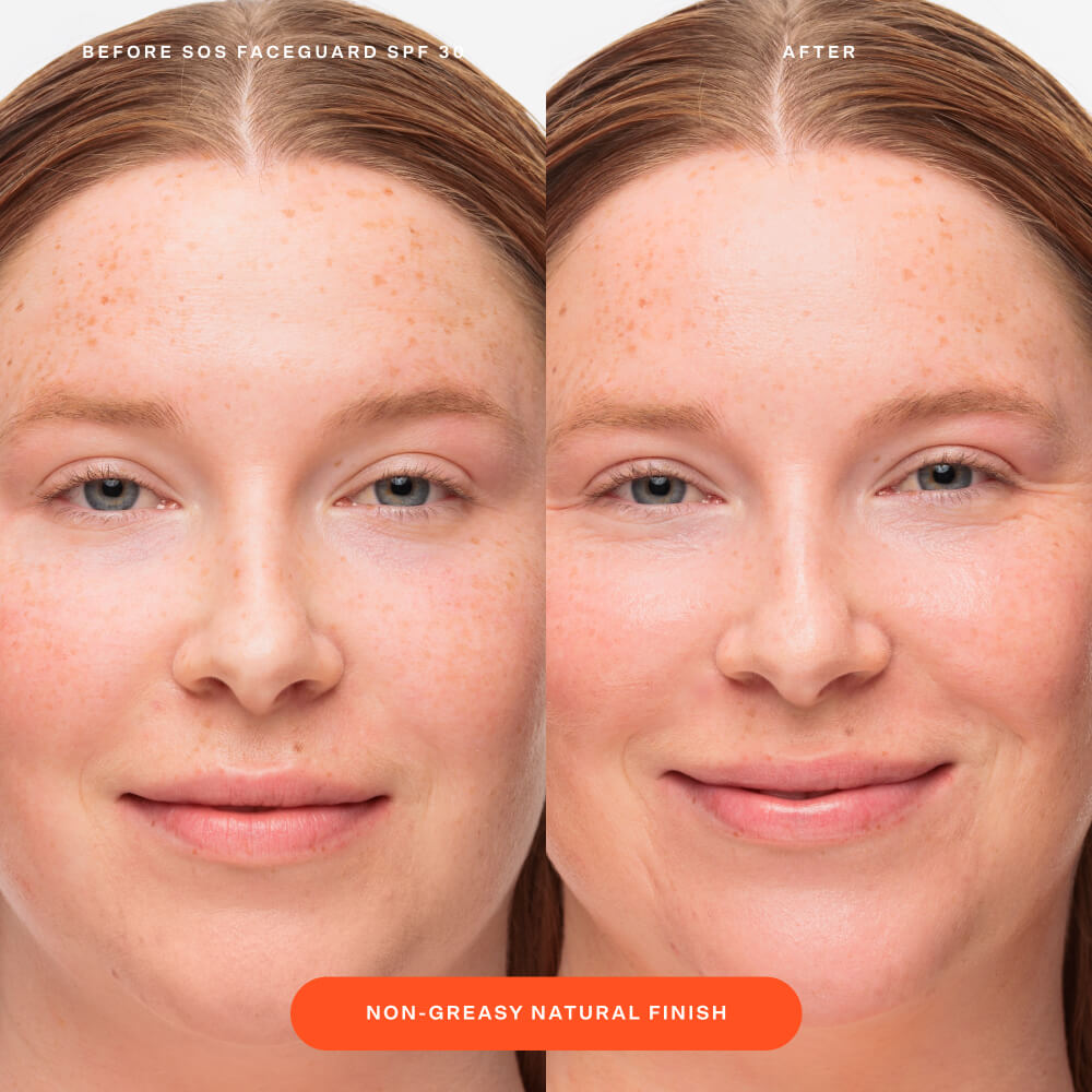 SOS FaceGuard™ SPF 30 Sunscreen PA+++ Q7