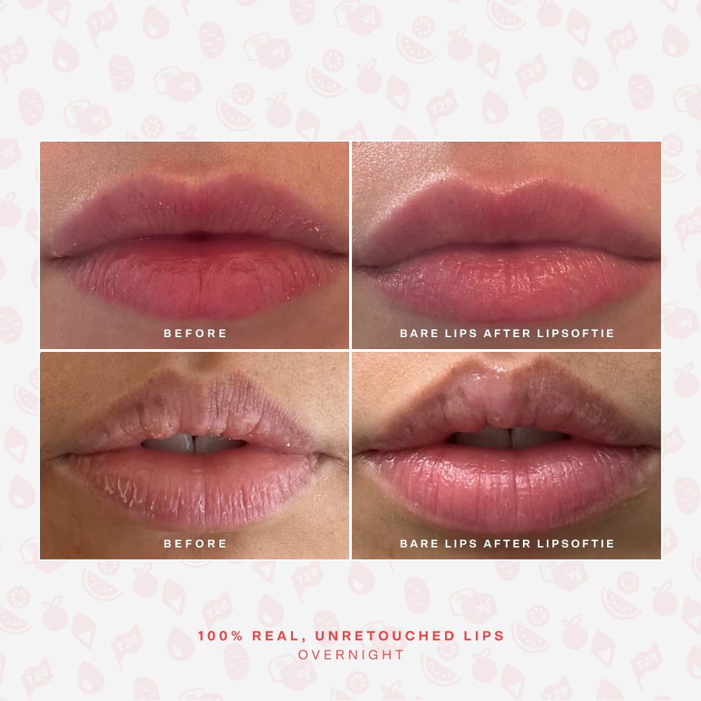 LipSoftie® Lip Treatment Set A3