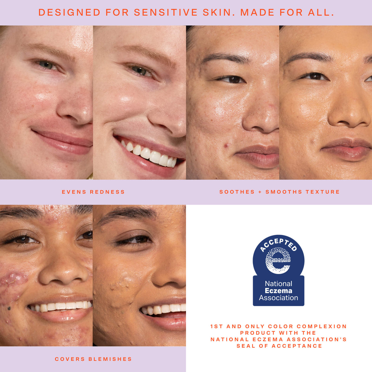 SunnyDays™ Tinted SPF 30 L1