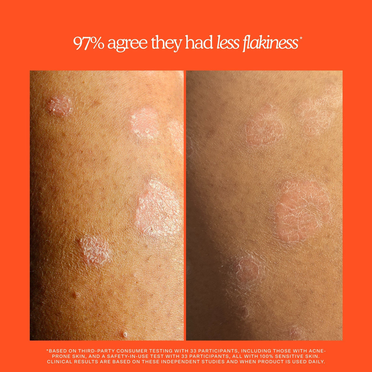 SOS Rescue + Relief Body Wash Treatment O9