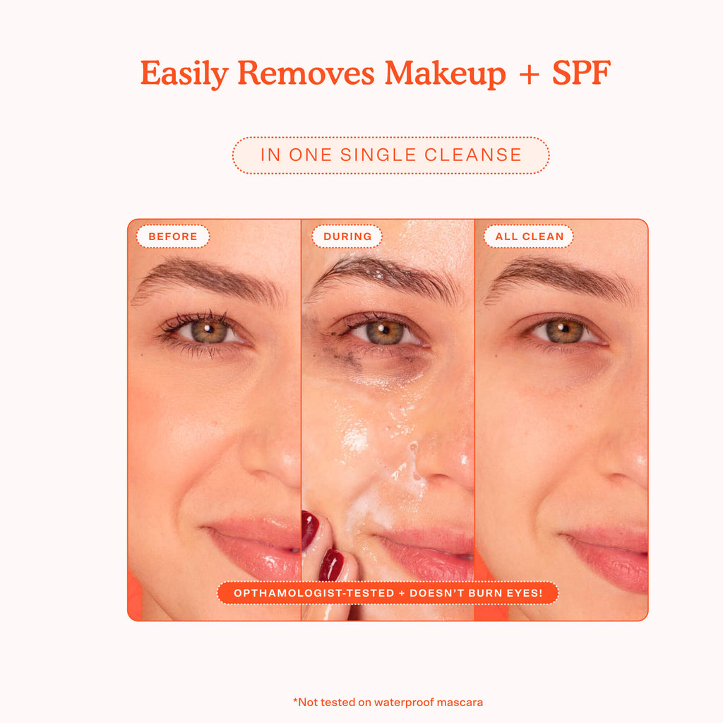 SOS Gel Cleanser A2